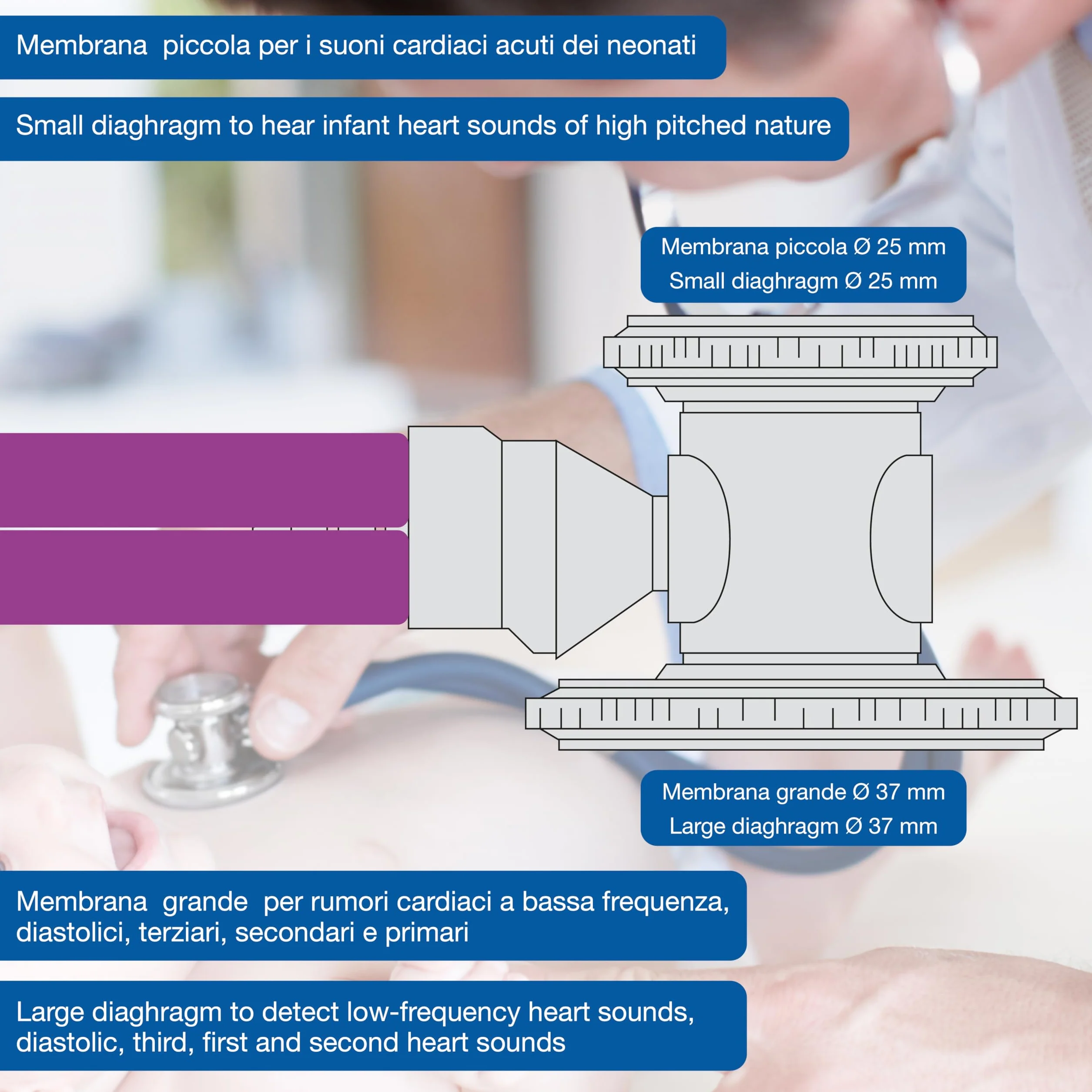 GIMA Jotarap Stéthoscope à tête double et double tube de type Rappaport pour cardiologie et urgences, violet